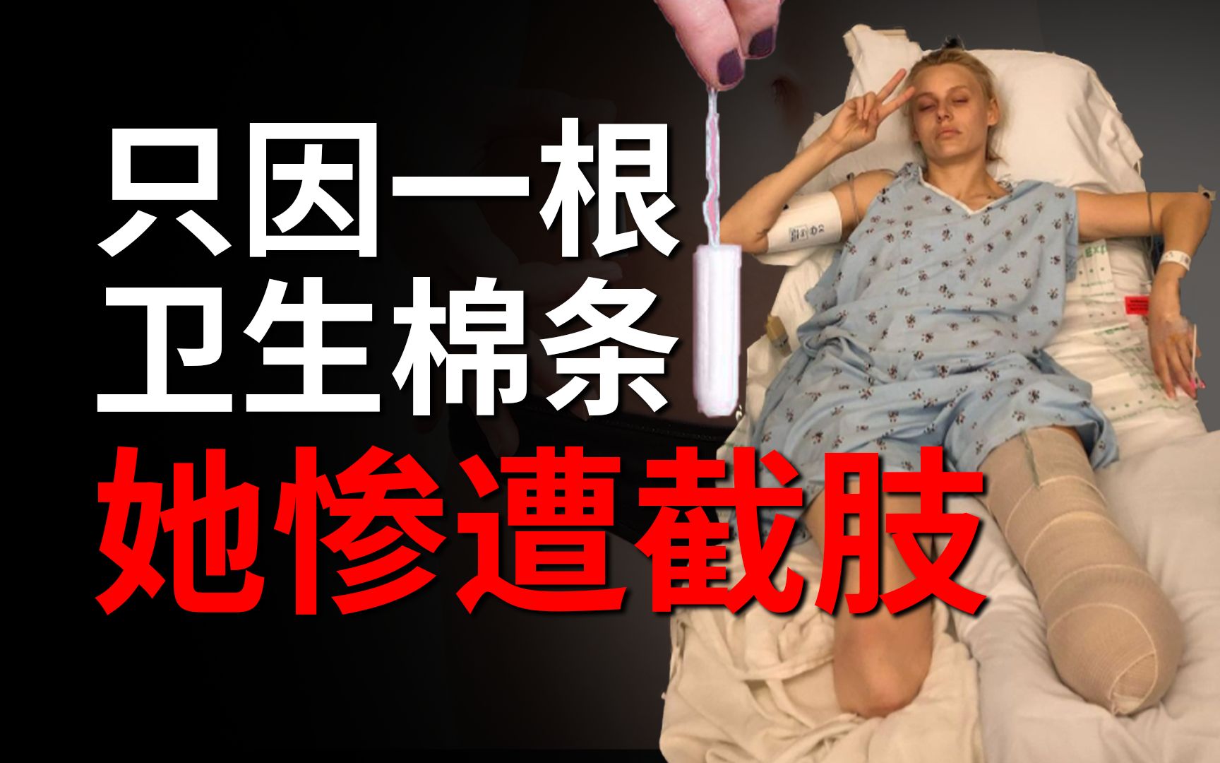 因为一根卫生棉条，她惨遭截肢