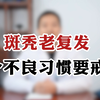 斑秃老复发 4个不良习惯要戒掉
