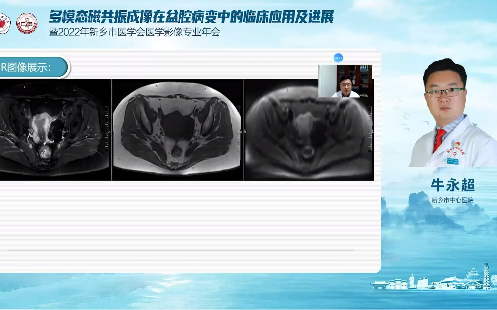 图1-59 女性盆腔(CT图像)-妇产科临床解剖学-医学
