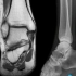 踝关节MRI解剖详解。