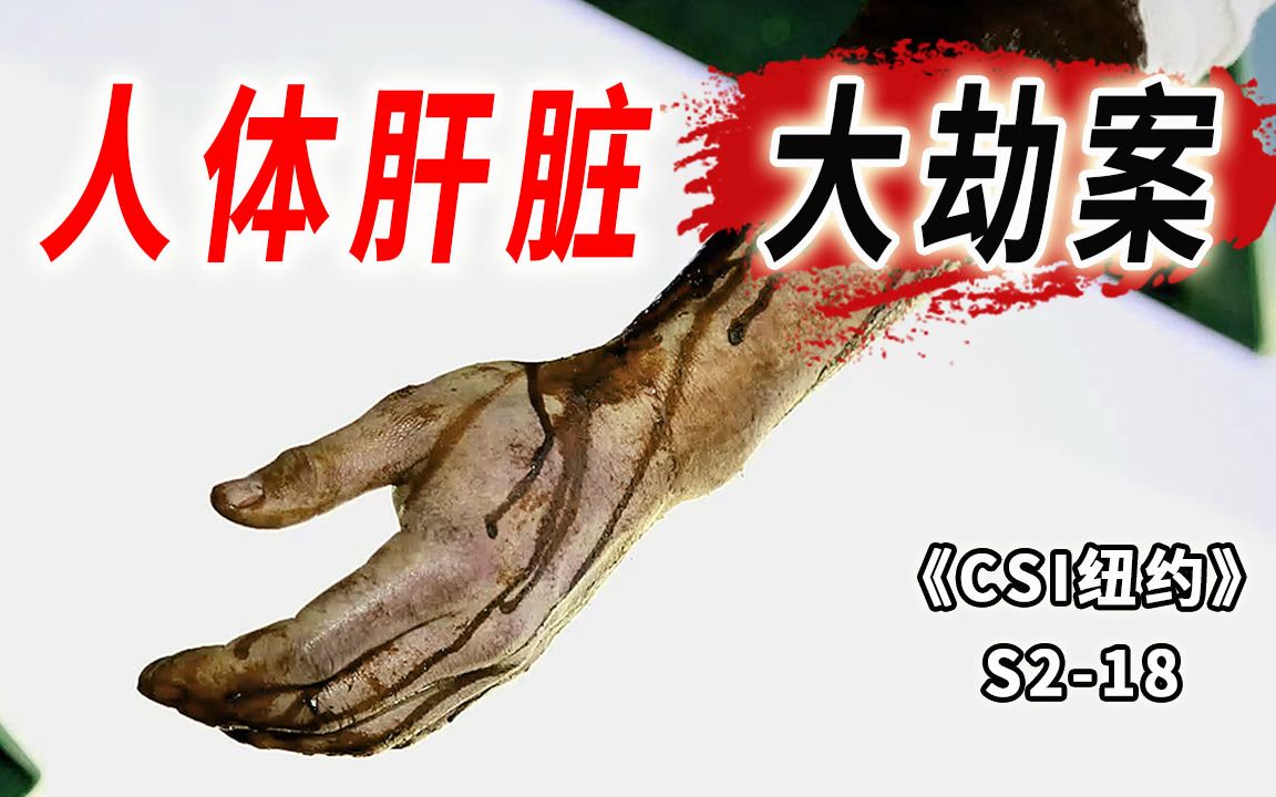 这年头什么都有人抢！救命肝脏途中被截胡，移植病人命悬一线《CSI纽约》S2-18