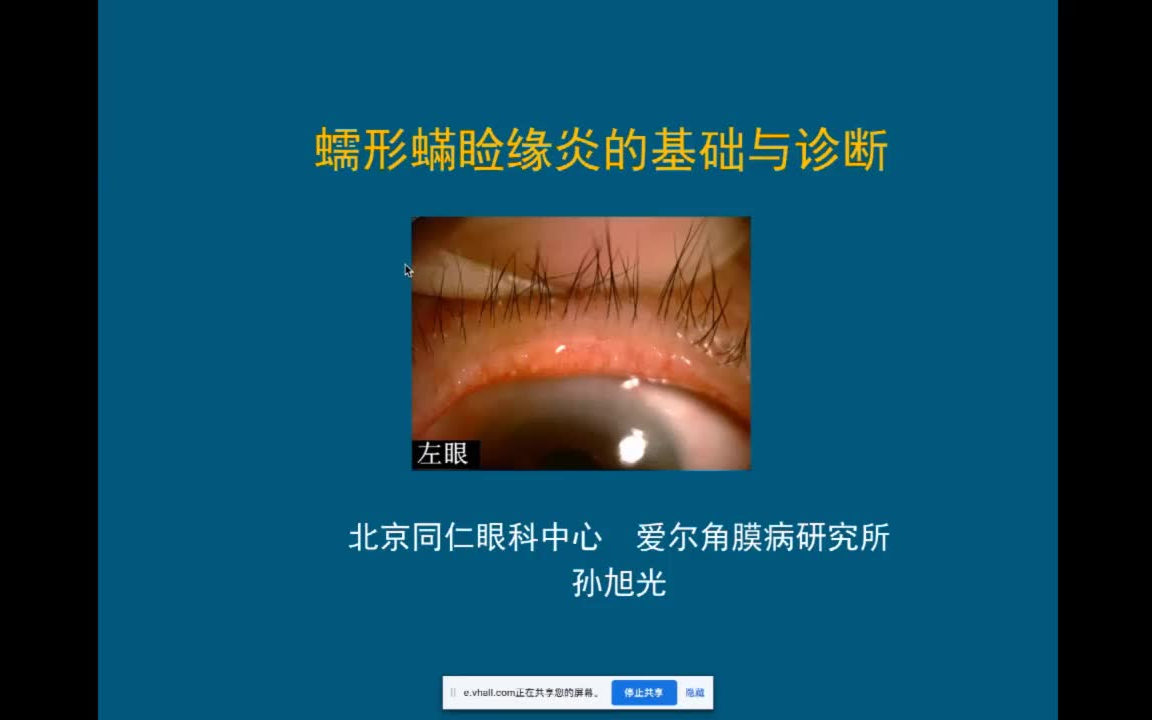 蠕形螨睑缘炎的基础与诊断孙旭光