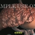 【3D医学动画】达叔得了▂肝癌▂走了  肝穿刺是确诊肝癌的重要指标！