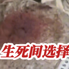 甘肃兰州：生死之间的抉择