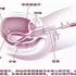 宫腔镜技术
