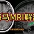 影像基础：海马MRI解剖分享讲解，2分钟学会！
