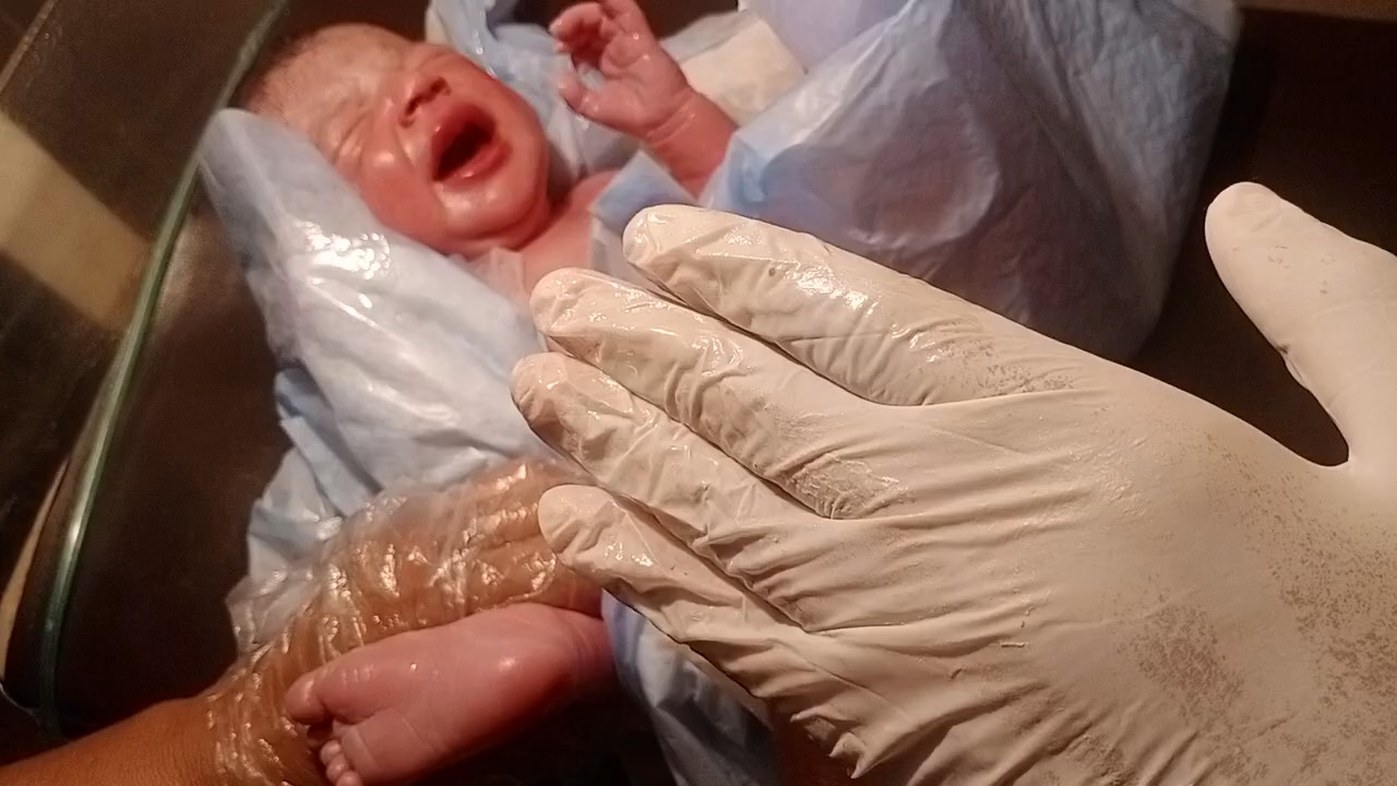 帮刚出生哭闹很强的女宝宝清洁！