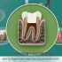 【科普】3分钟了解什么是牙髓治疗？