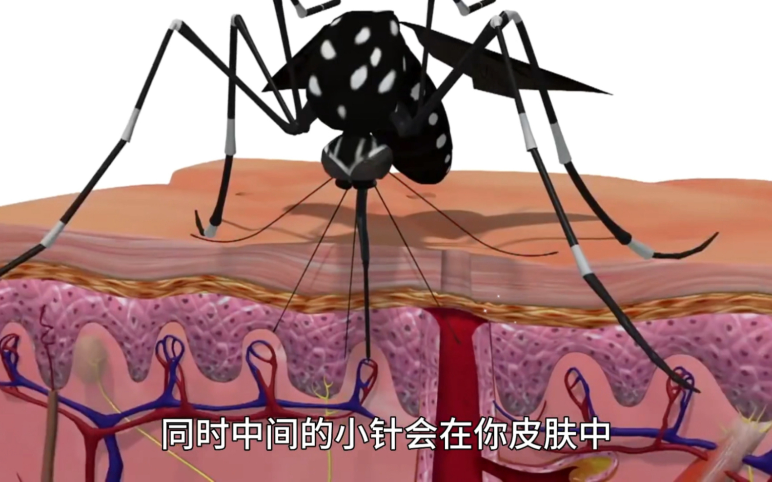 蚊子在叮咬的过程中到底做了什么？