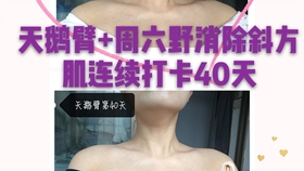 斜方肌怎么消 0bc70bde4637be59b059afd8b270172a107fc24d.jpg@280w_158h_1c_100q.jpg