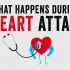 【TED科普】心脏病发作时会发生什么？（中英字幕）