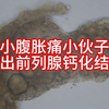 小腹胀痛小伙子，排出前列腺钙化结石