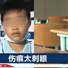 三亚一小学生称被老师打了40多下，屁股发紫肿胀，区教育局回应