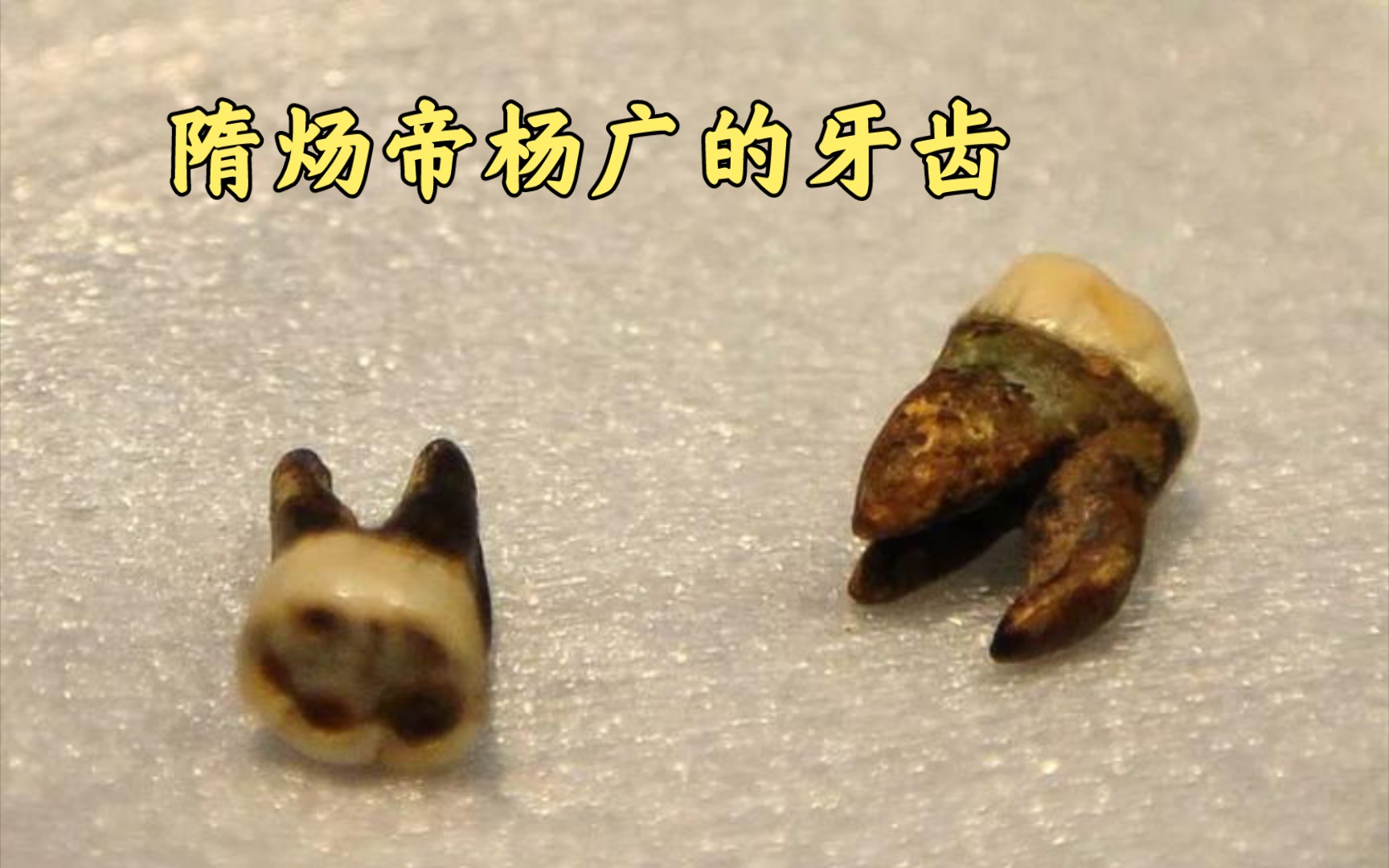 隋炀帝杨广的牙齿