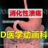 【3D医学动画科普】消化性溃疡（中英双语字幕）