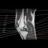 6.关节MRI解剖图谱-膝关节MRI解剖