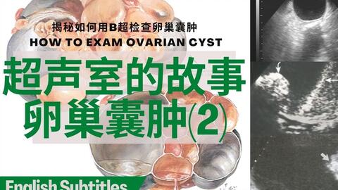 阑尾炎症状是什么样的 0ec2be67036ae6a75ddedee160942ec7a1224f9d.jpg@480w_270h_1c