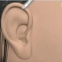 3D动画演示：耳软骨隆鼻！