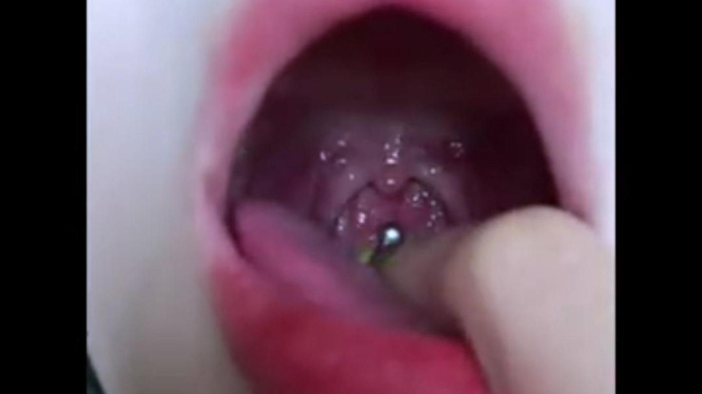 【口腔检查21】你抽查口腔我放心