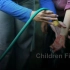 英国红十字会儿童急救系列 Children First Aid- 烧伤