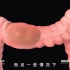 肠易激综合征IBS-排便过程-便秘-腹泻-缓解方式