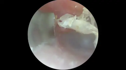 今天是挖耳皮 好久不见呀大家