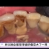 【洗牙】这样洗牙，深圳某口腔诊所亏了五万！