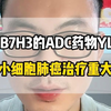 靶向B7H3的ADC药物YL201，实现小细胞肺癌治疗重大突破