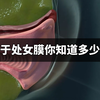 从科学的角度 正确认识处女膜