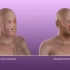 胆小勿入，半脸移植手术过程，3D演示。。