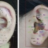 中医+人工智能黑科技：耳朵穴位经络图像识别