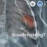 肺部肿瘤放疗的时候要屏住呼吸吗？