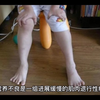 杜氏肌营养不良是什么意思