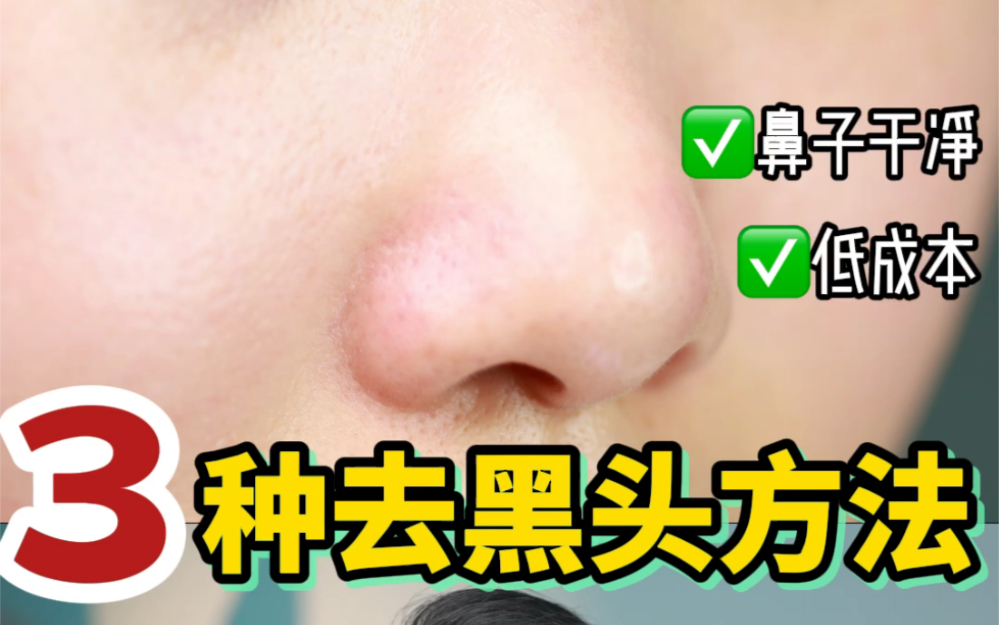 三种去黑头方法❗️简单有效✅做完鼻子超干净
