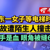 广东一女子等电梯时 无故遭陌生人撞击 双手是血 眼角被缝6针
