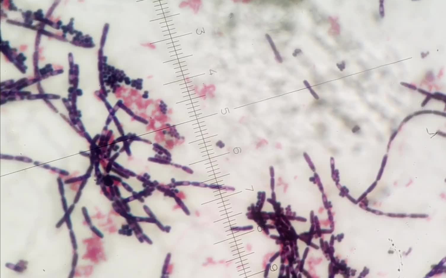 常见细菌可以用普通光学显微镜看到吗？ - 知乎