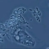电子显微镜下人体内白细胞吞噬细菌，不愧是人体卫士
