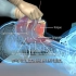 口咽通气道置入-3D医学动画