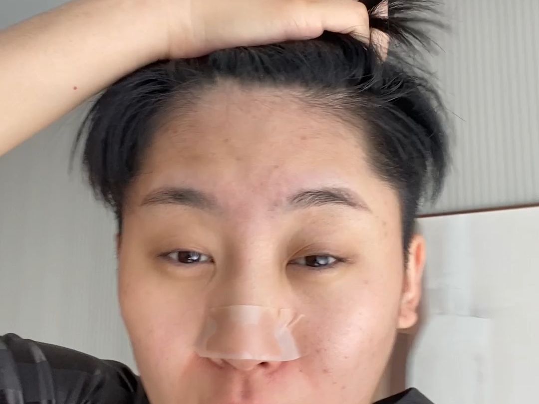 3块5的人工皮还能去黑头？