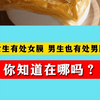 女生有处女膜，男生也有处男膜，你知道在哪吗