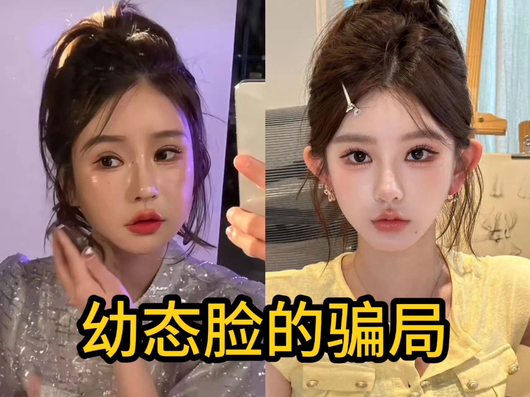 全脸66支玻尿酸，是幼态模板还是畸形审美？