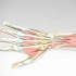 3D视频：手指肌腱断裂修复手术