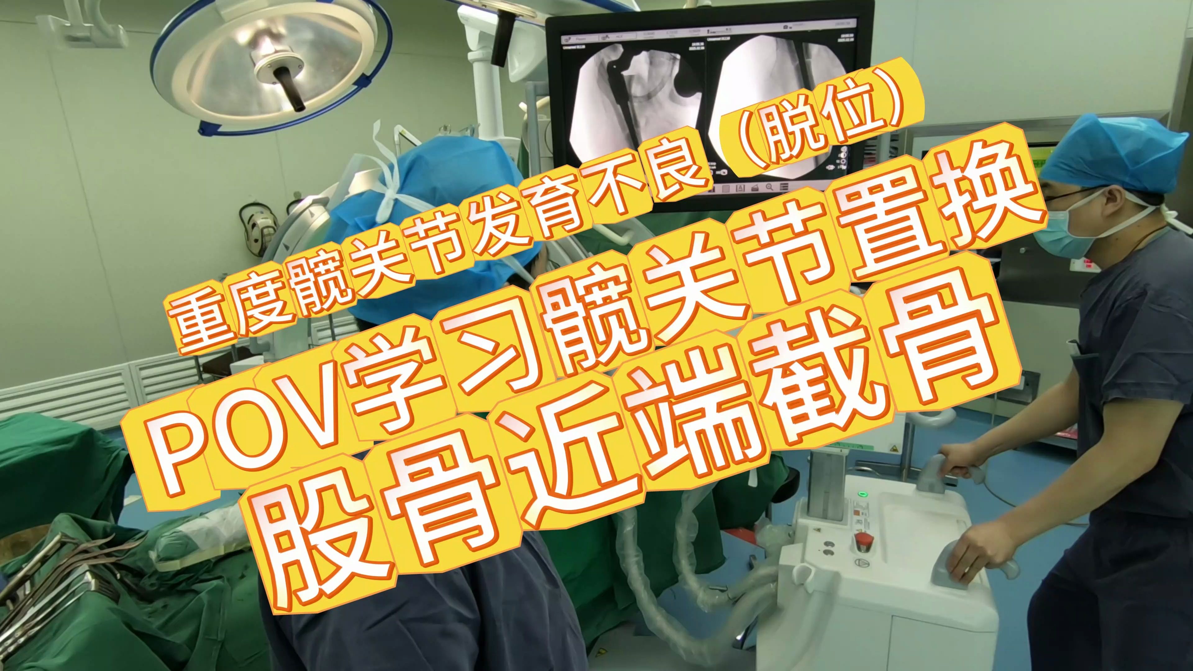【大手术】重度髋关节发育不良高位脱位——股骨近端截骨短缩手术