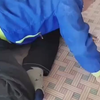 肌营养不良的危害