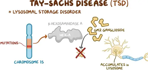 [英文字幕] 黑蒙性痴呆症 | 台-萨氏综合征 Tay-Sachs Disease (TSD) 介绍