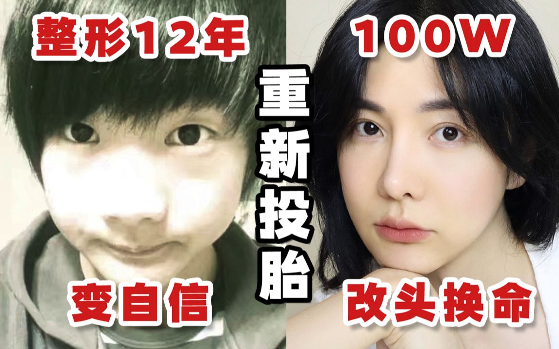 重新投胎 整形12年花了100万 整到我妈不认识我了 最全整容史分享 帮想整容的妹妹们防雷避坑 哔哩哔哩