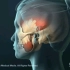 张嘴困难，看看是不是颞下颌关节紊乱，3D演示。。