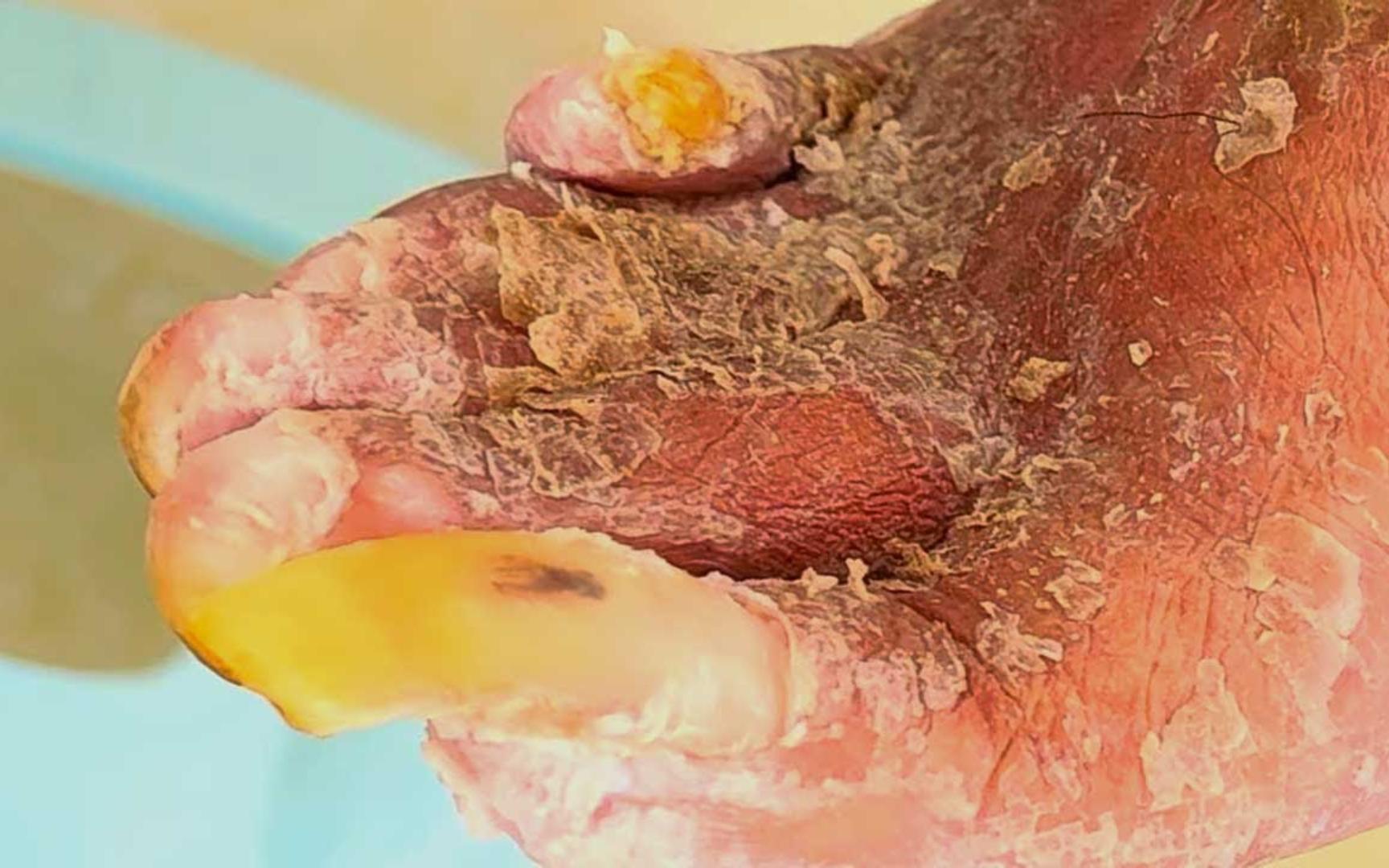 两年没洗脚的人指甲都长得很脏！