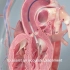 3D演示人工心脏瓣膜工作原理