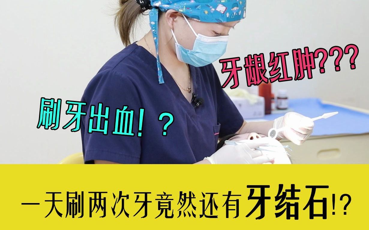 牙龈红肿刷牙出血牙结石了解一下